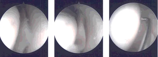 Intraoperative images