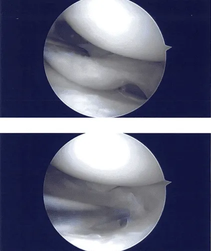 Imágenes intraoperatorias