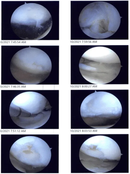 Intraoperative images