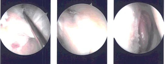 Intraoperative images