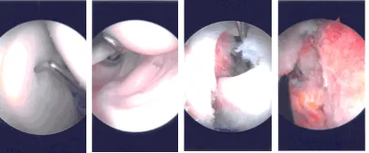 Intraoperative Arthroscopy Images