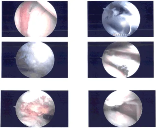 Foto intraoperatoria