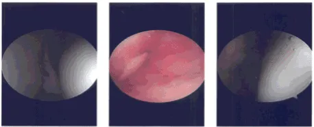 Intraoperative photo