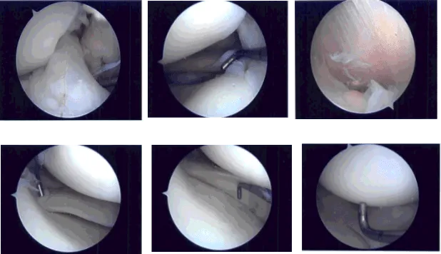 Foto intraoperatoria