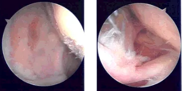 Imágenes intraoperatorias