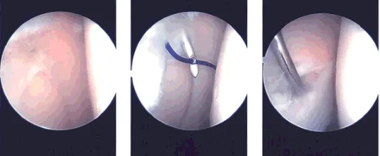 Imágenes intraoperatorias