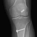 sports xray