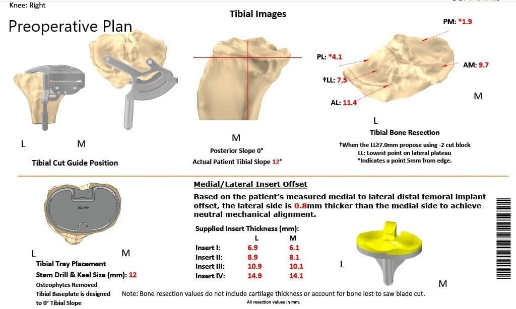 Un plan quirúrgico específico para un paciente en Complete Orthopedics en Nueva York