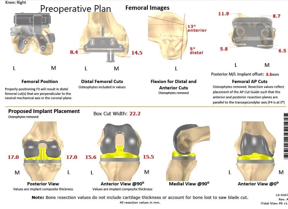 Plan quirúrgico específico para un paciente en Complete Orthopedics en Nueva York - escáner 2