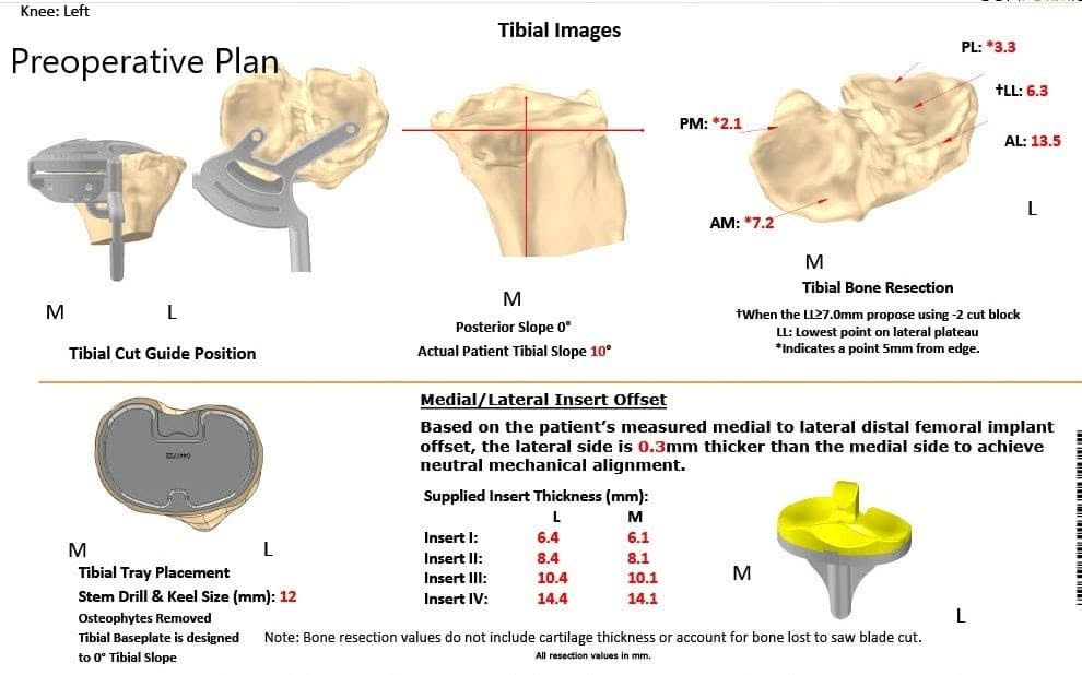 Un plan quirúrgico específico para un paciente en Complete Orthopedics en Nueva York - ecografía 3