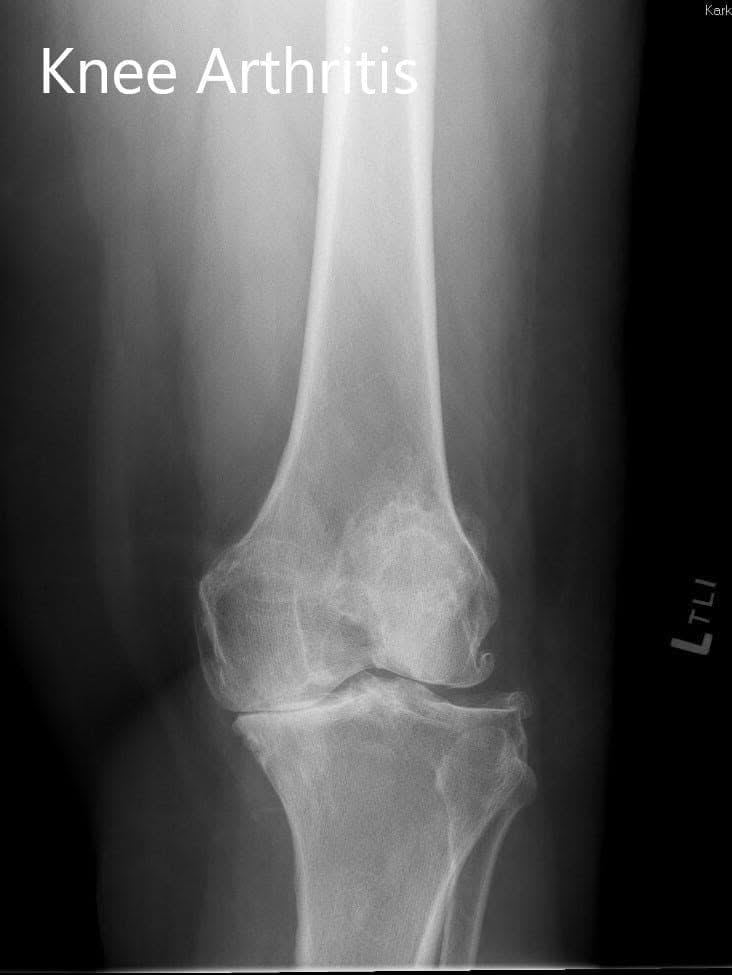 Radiografía preoperatoria mostrando las vistas lateral y AP - img 2
