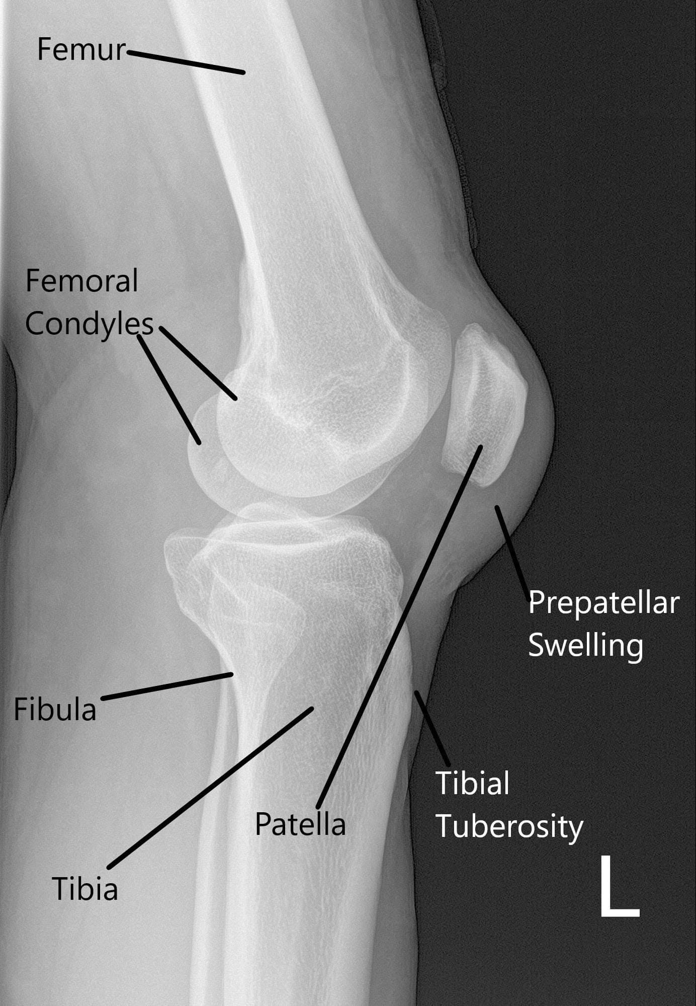 X-ray of the left knee in lateral view X-ray of the left knee in lateral view