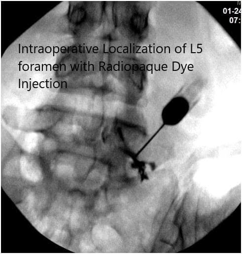 Intraoperative Fluoroscopy Images 2 Intraoperative Fluoroscopy Images 2