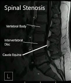 Resonancia magnética que muestra secciones sagital y axial Resonancia magnética que muestra secciones sagital y axial