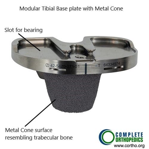 odular tibial component with metaphyseal cone
