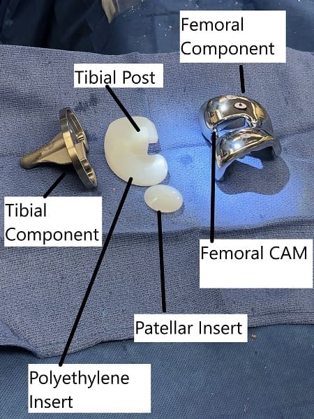 Piezas de recambio de rodilla