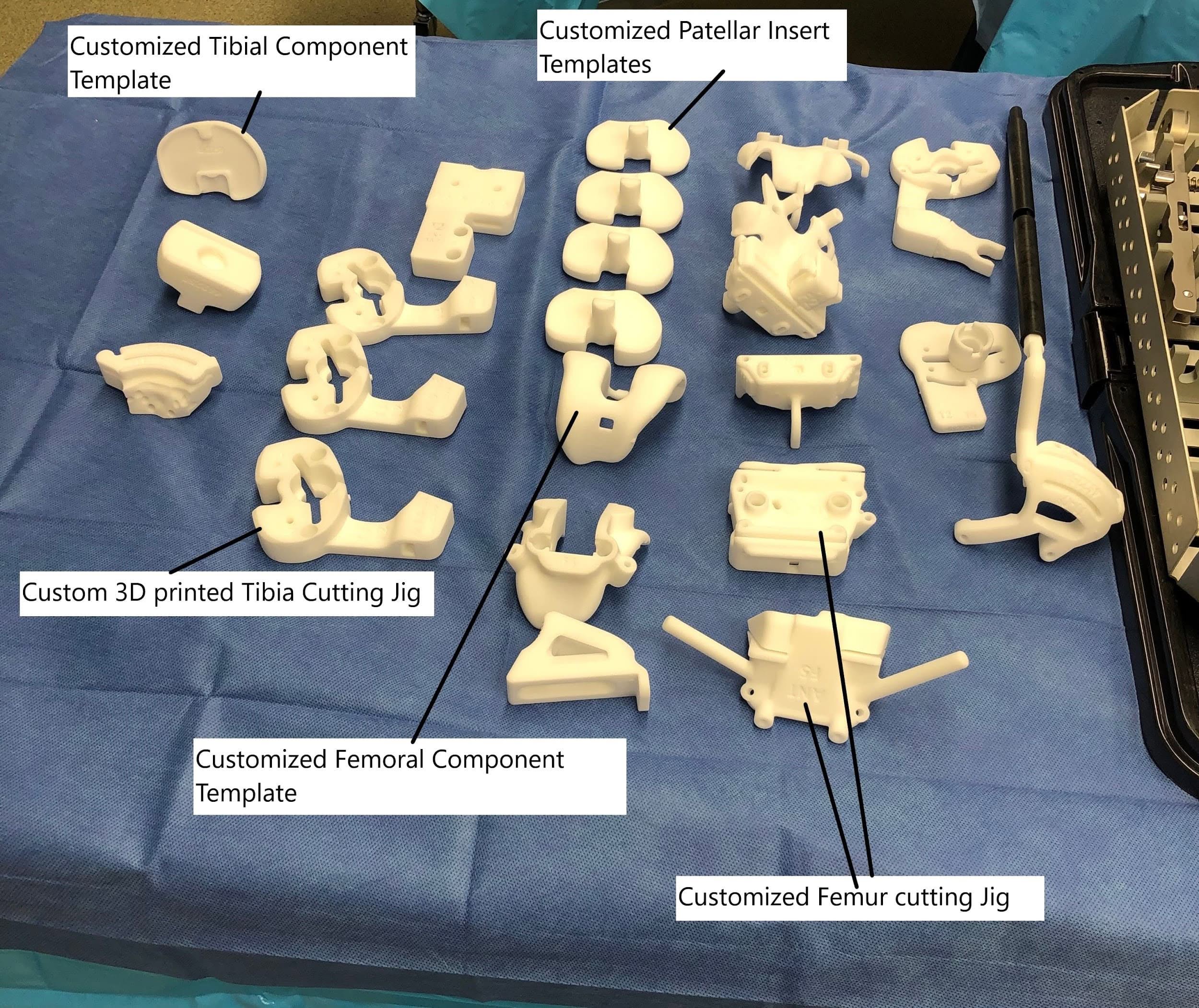 Instrumentos y plantillas personalizados impresos en 3D para la asistencia a la artroplastia de rodilla