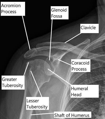 Radiografía de la anatomía del hombro