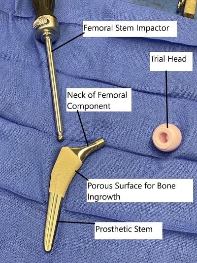 Total Hip Replacement Components.