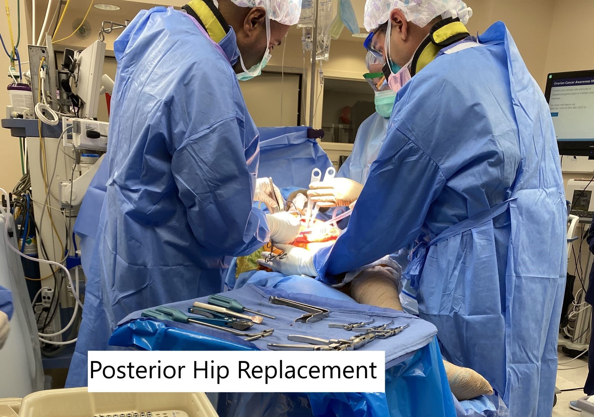 Imagen intraoperatoria que muestra la prótesis posterior de cadera.