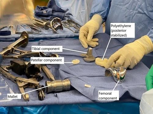 Imagen intraoperatoria que muestra un componente protésico.