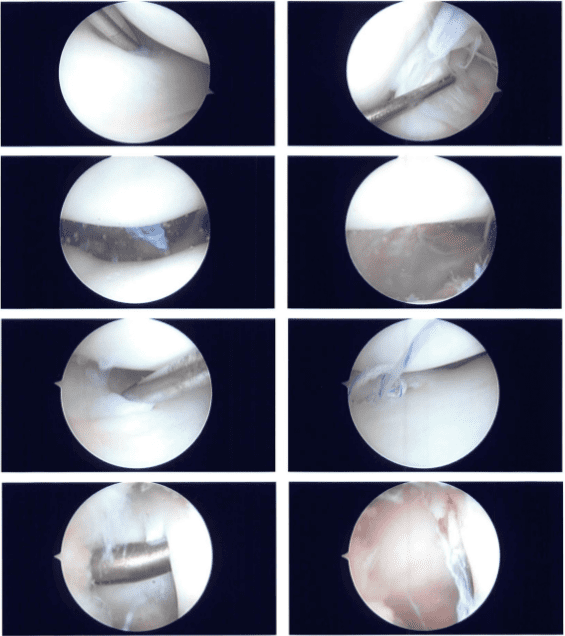 Imágenes intraoperatorias