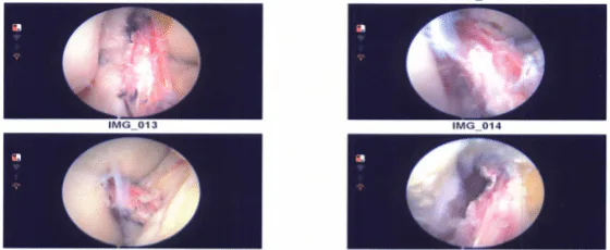 Intraoperative images