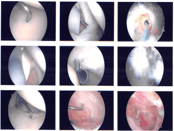 Imágenes intraoperatorias