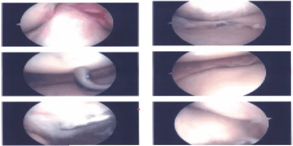 Imágenes intraoperatorias