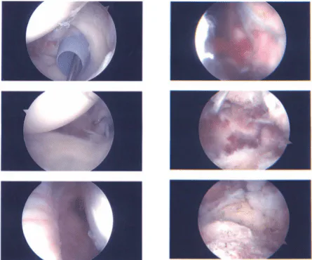 Intraoperative report