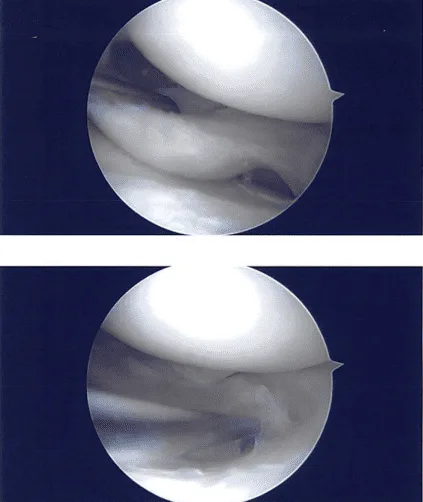 Imágenes intraoperatorias