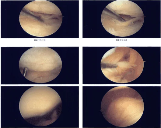 Intraoperative photo