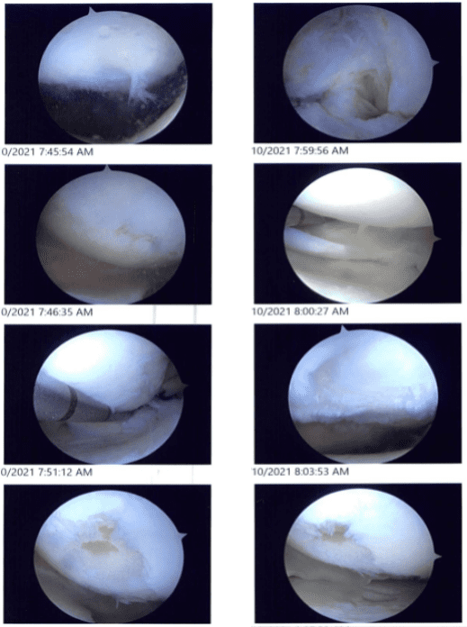 Intraoperative images