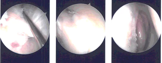 Imágenes intraoperatorias
