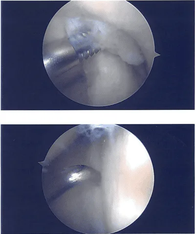 Intraoperative images