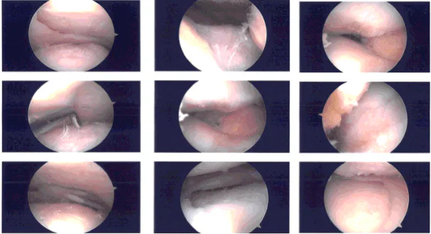 Intraoperative images