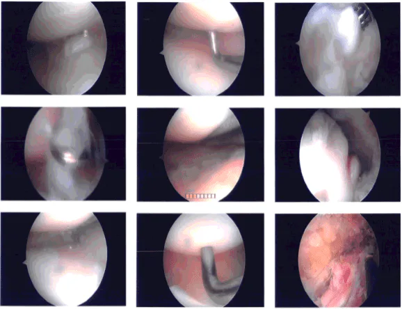 Intraoperative photo