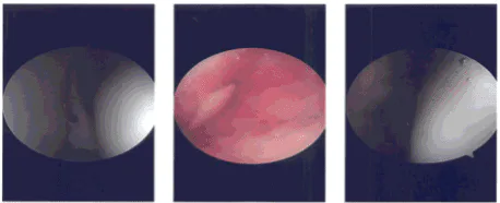 Intraoperative photo