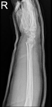 Intraoperative images
