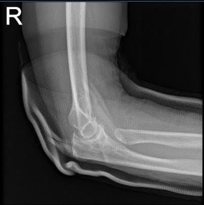 Right wrist x-ray 3 or more views