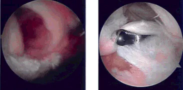Intraoperative Images Intraoperative Images