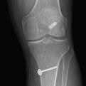 sports xray